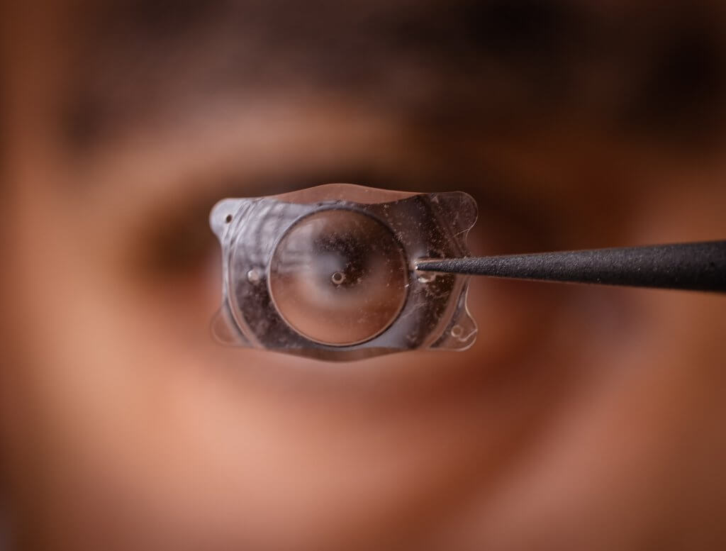 Nahaufnahme einer Implantatlinse vor einem unscharfen Auge, gehalten von einer Pinzette.