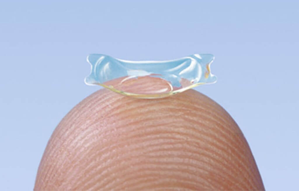 Nahaufnahme einer implantierbaren Kontaktlinse auf einer Fingerspitze vor blauem Hintergrund.